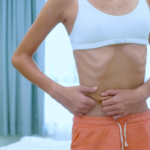 Anorexia nervosa – en dödlig sjukdom